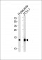 FABP4 Antibody